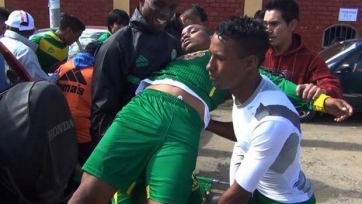 Шок в Перу - фанаты избили футболиста прямо после матча