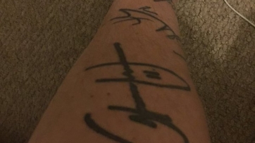 Бывший поклонник Адама Джонсона стёр татуировку в его честь своей ноги