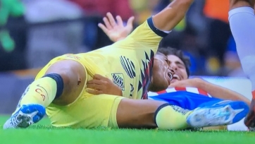 Ужасная травма дос Сантоса в матче чемпионата Мексики. Видео